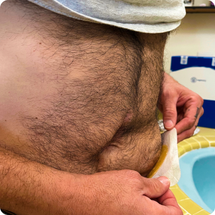 Een man die een huidbarrière toepast