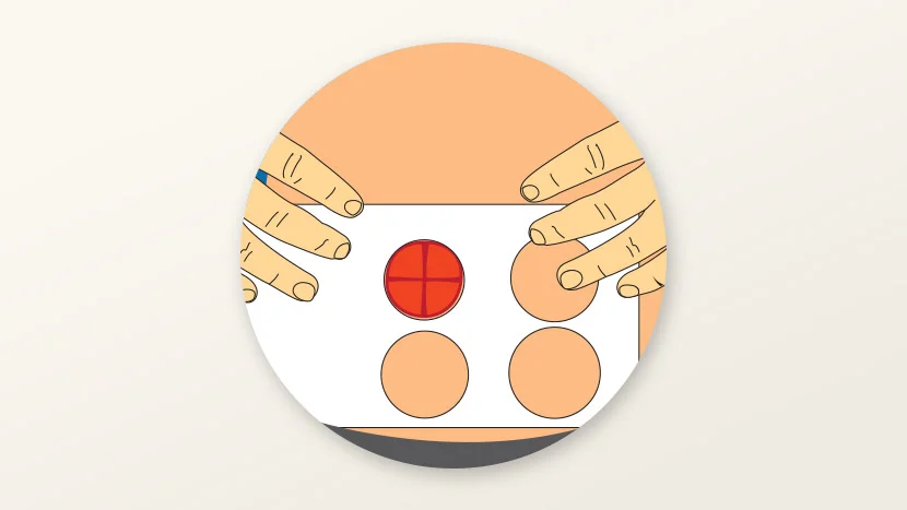 Ilustración de cómo medir un estoma