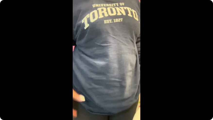 Renee Welch shows us her routine for showering and going to the beach with an ostomy pouch. 