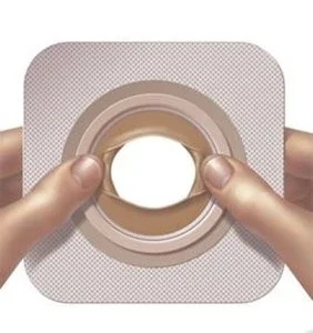 Convatec 可模塑技術™皮膚屏障