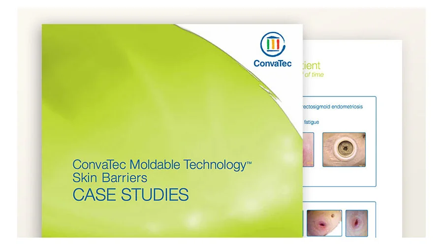 グラフィカルユーザーインターフェイス